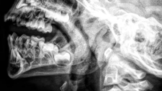 Red & Infrared LED for TMD - Lumaflex