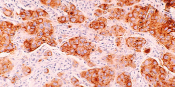 630nm Photobiomodulation by low-power laser irradiation attenuates Aβ-induced cell apoptosis through the Akt/GSK3β/β-catenin pathway