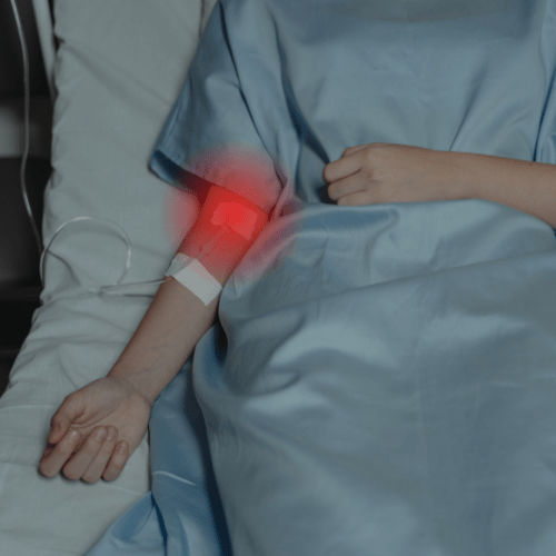 Red Light Therapy for Cancer: How It Works, Benefits, and Current Research - Lumaflex