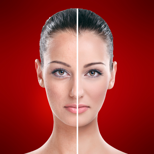 Red light therapy before and after