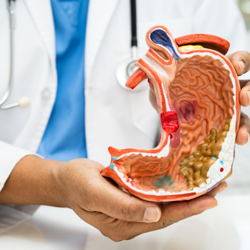 Red Light Therapy for Stomach