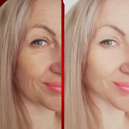 Red Light Therapy Results Lumaflex